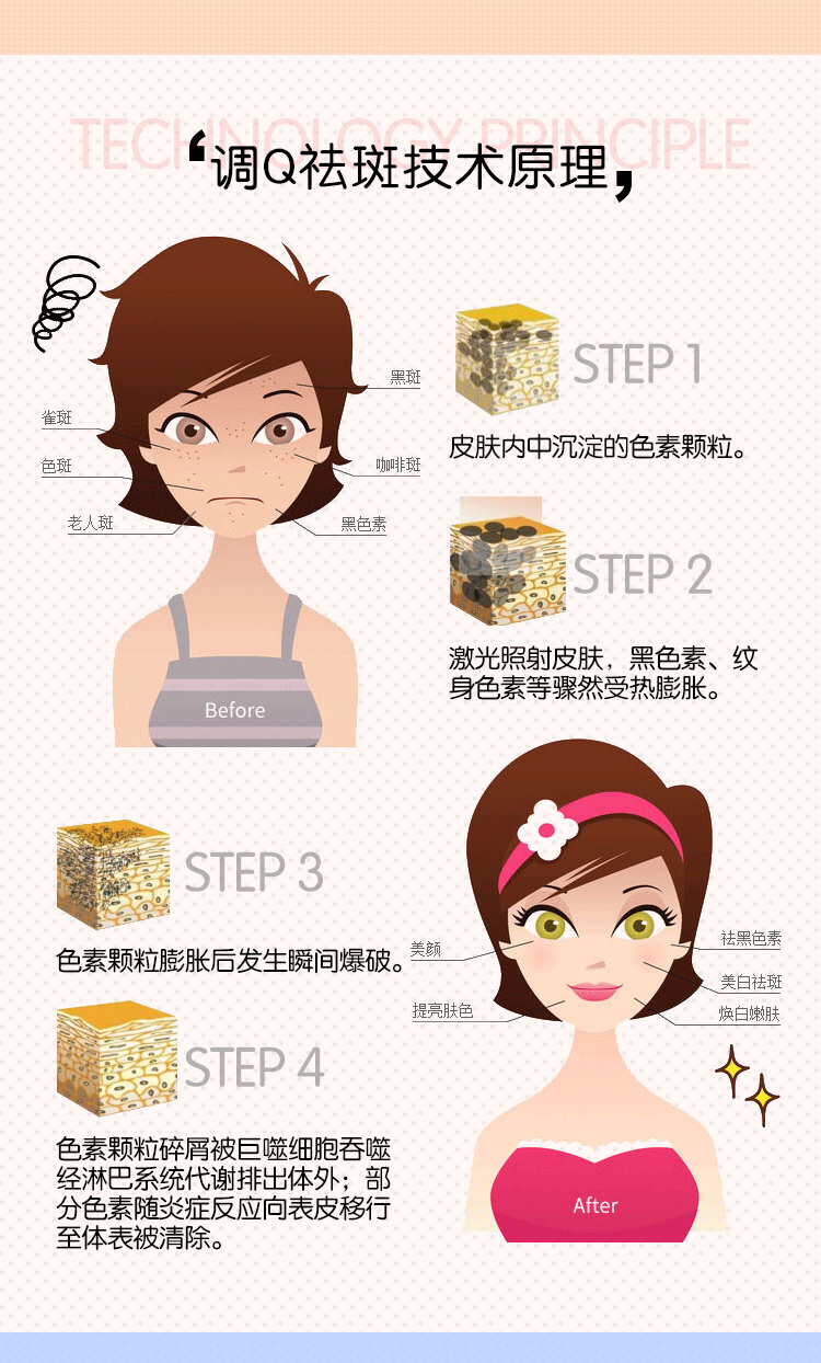 调Q祛斑