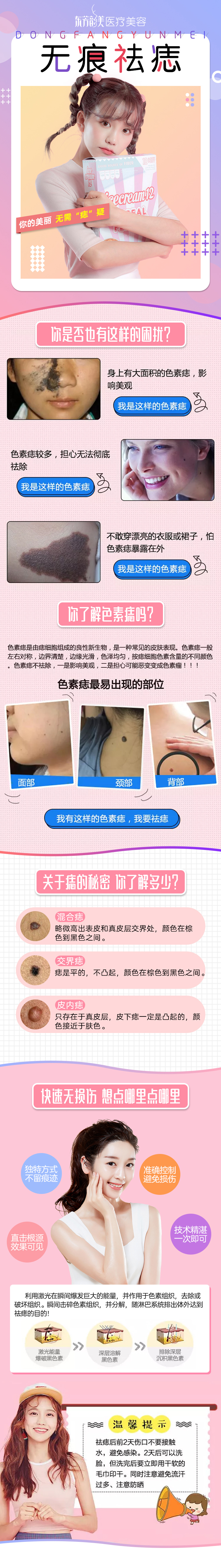 无痕祛痣